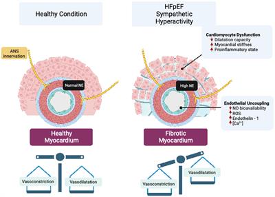 Vascular dysfunction in HFpEF: Potential role in the development, maintenance, and progression of the disease